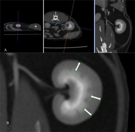  Διαστάσεις των φυσιολογικών νεφρών της γάτας με χρήση αξονικής τομογραφίας