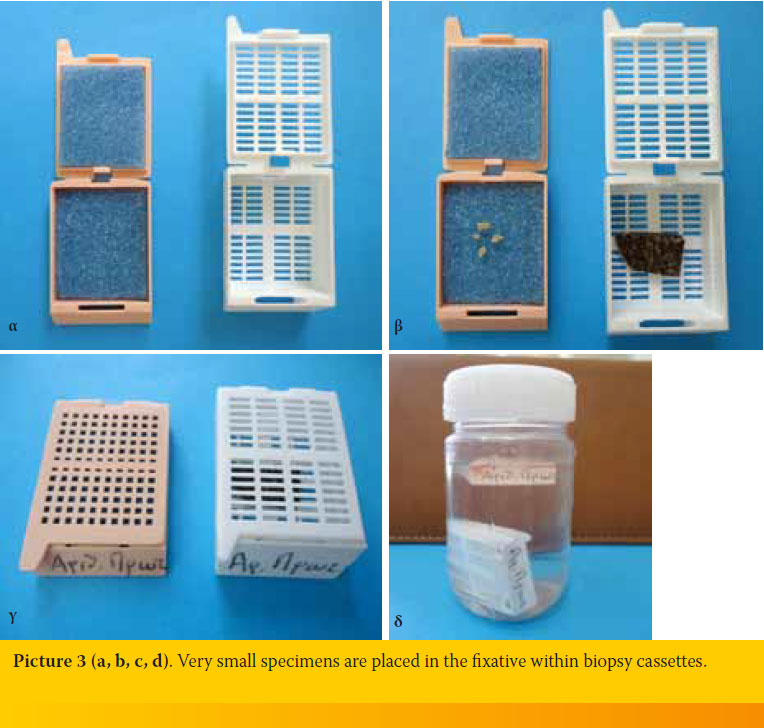 Τissue handling by the practitioner; from collection to submission of the sample to the histopathology lab