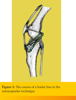 Update on the diagnosis and therapy of canine cruciate ligament rupture