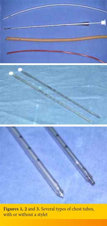 Thoracostomy tube placement