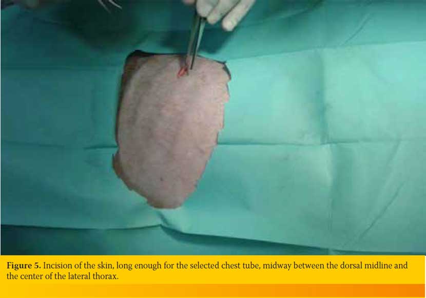 Thoracostomy tube placement