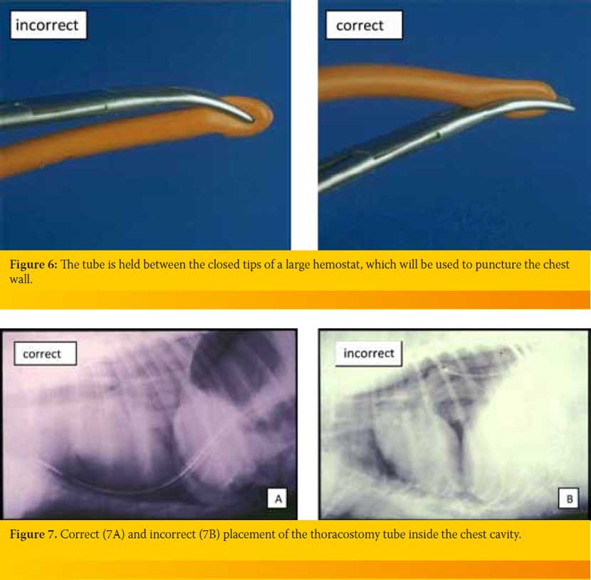 Thoracostomy tube placement