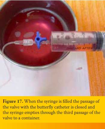 Pleural cavity puncture (Thoracocentisis) in the dog