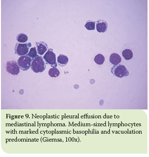 Pleural effusion in the cat: a focus on laboratory diagnosis 