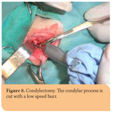 Hellenic Journal of Companion Animal Medicine - Volume 6 - Issue 2 - 2017 - Fractures of the mandible in cats. Retrospective study of 23 cases