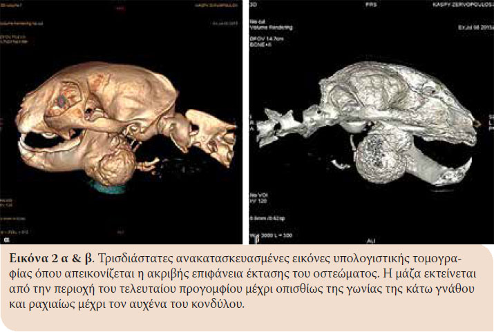 Περιστατικό οστεώματος της κάτω γνάθου σε γάτα