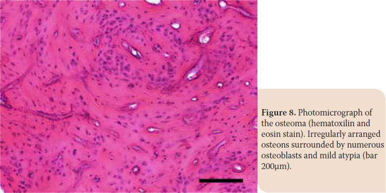 Osteoma of the mandible in a cat