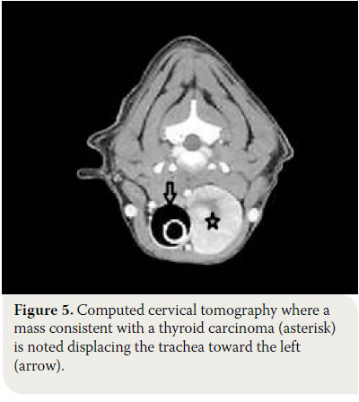  Canine thyroid tumours: diagnosis and treatment 