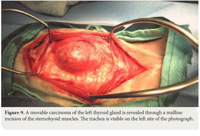  Canine thyroid tumours: diagnosis and treatment 