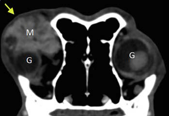 Neoplasia of lacrimal gland origin in a dog