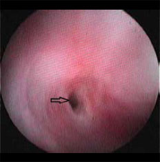 Oesophageal strictures associated with oral antibiotics in cats-a report of three cases