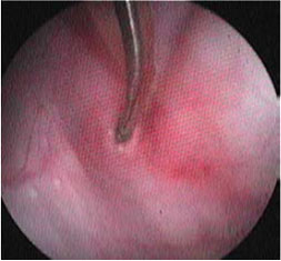 Oesophageal strictures associated with oral antibiotics in cats-a report of three cases