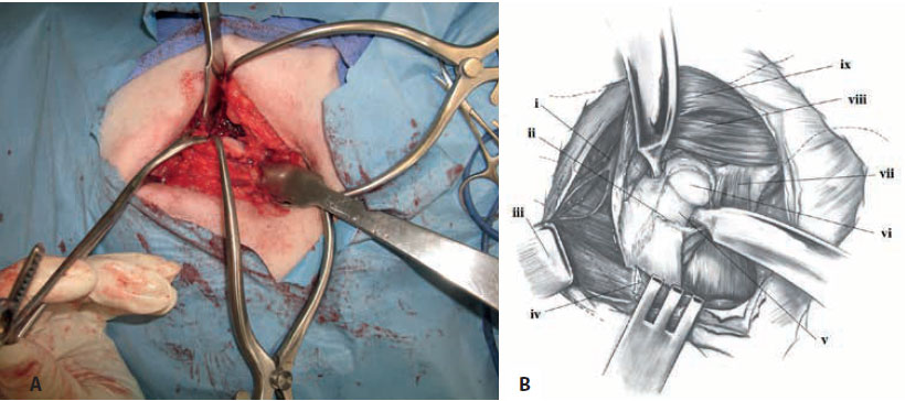 v8i2 femoral head excision img13