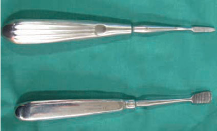 v8i2 femoral head excision img15