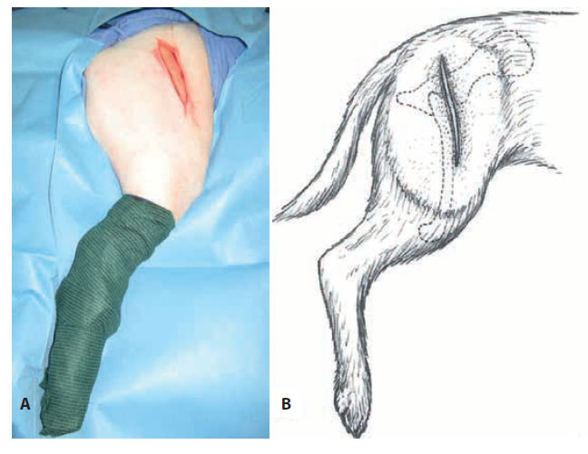 v8i2 femoral head excision img2