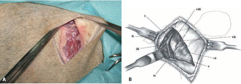 v8i2 femoral head excision img4